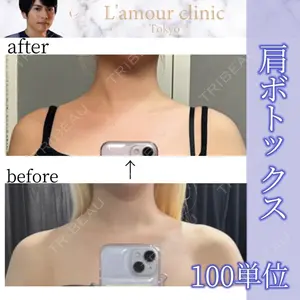 L‘amour clinic Tokyo【ラムールクリニック東京】 片岡 紘士医師の症例