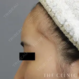 THE CLINIC（ザ・クリニック）東京院の症例