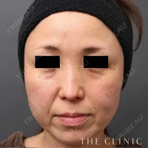 THE CLINIC（ザ・クリニック） 東京院の症例