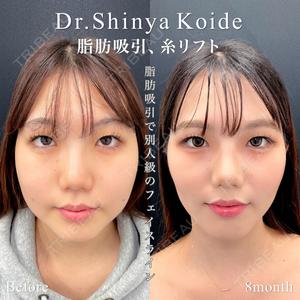 東京シンデレラ美容外科 池袋院の症例