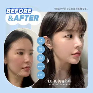 LUHO（ルホ）美容外科の症例