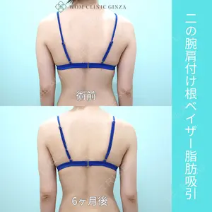 WOM CLINIC GINZA （ワム クリニック ギンザ） 佐々木 和司医師の症例