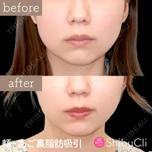渋谷美容外科クリニック 渋谷院 中島 透医師の症例