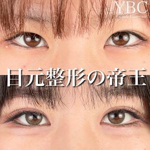 YBC横浜美容外科 池袋院 磯村 亮輔医師の症例