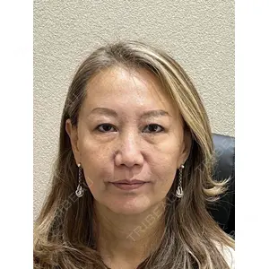 お茶の水美容形成クリニックの症例
