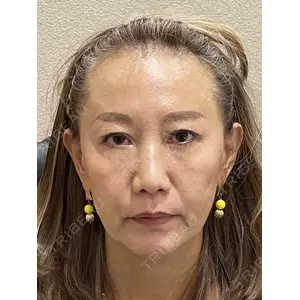 お茶の水美容形成クリニックの症例