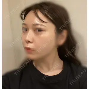 加美（GAMI）整形外科 パク・ゴヌク医師の症例