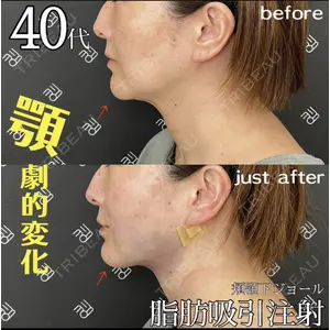 EMMO FACE CLINIC 大阪梅田院 山﨑 冴羅医師の症例