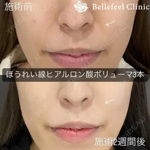 Bellefeel Clinic 代官山 兵藤 秀忠 医師の症例