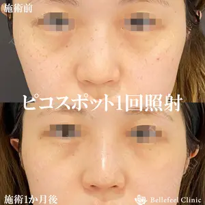 Bellefeel Clinic 代官山 兵藤 秀忠 医師の症例