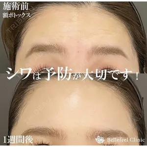 Bellefeel Clinic 代官山 兵藤 秀忠 医師の症例