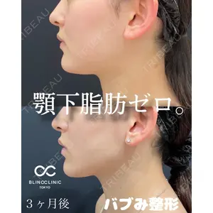 BLINC CLINIC （ブリンク クリニック） 柳川 央徒医師の症例
