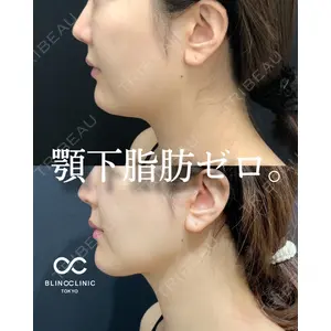 BLINC CLINIC （ブリンク クリニック） 柳川 央徒医師の症例
