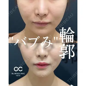 BLINC CLINIC （ブリンク クリニック） 柳川 央徒医師の症例