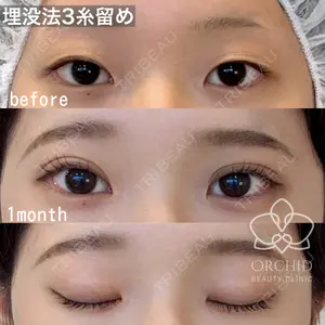 オーキッド美容クリニック東京御徒町 西浦 蘭子医師の症例