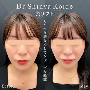 東京シンデレラ美容外科 池袋院の症例