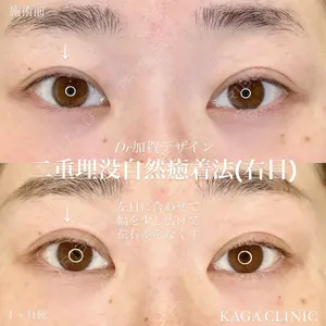 KAGA CLINIC 加賀 裕基医師の症例