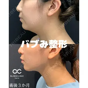 BLINC CLINIC （ブリンク クリニック） 柳川 央徒医師の症例