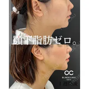 BLINC CLINIC （ブリンク クリニック） 柳川 央徒医師の症例