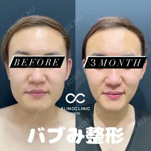 BLINC CLINIC （ブリンク クリニック） 柳川 央徒医師の症例