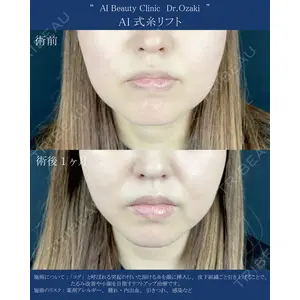 AI Beauty Clinic （エーアイ美容クリニック） 尾崎 宥文医師の症例