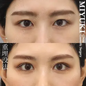 銀座みゆき通り美容外科 大阪梅田院の症例