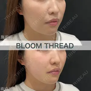 ブルームクリニック（BLOOM CLINIC）の症例