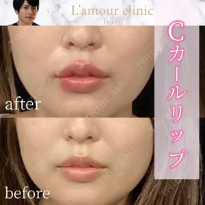 L‘amour clinic Tokyo【ラムールクリニック東京】の症例