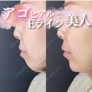 ルラ美容クリニック 広島院の症例