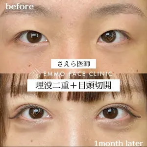 EMMO FACE CLINIC 大阪梅田院 山﨑 冴羅医師の症例