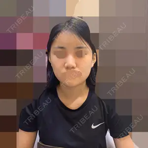 加美（GAMI）整形外科 パク・ゴヌク医師の症例