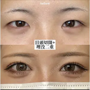 EMMO FACE CLINIC 大阪梅田院 山﨑 冴羅医師の症例