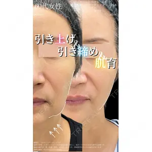 湘南美容クリニック 大阪梅田院の症例