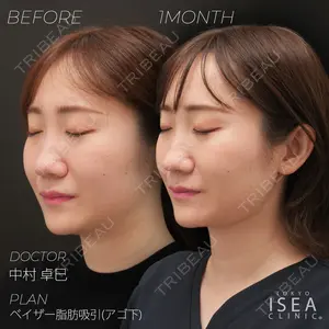 東京イセアクリニックの症例