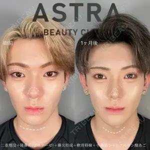 ASTRA BEAUTY CLINIC 塩満 惠子医師の症例