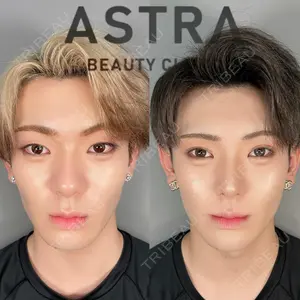ASTRA BEAUTY CLINIC 塩満 惠子医師の症例