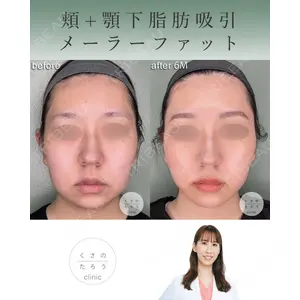 くさのたろうクリニック 立雅恵医師の症例