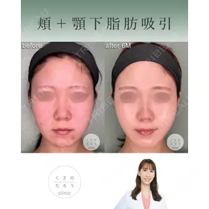 くさのたろうクリニック 立雅恵医師の症例
