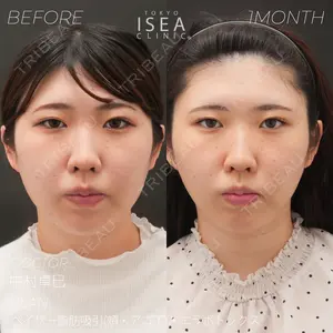 東京イセアクリニックの症例