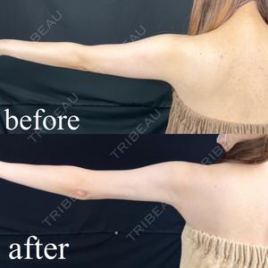 藤・ナチュレ美容クリニック 銀座院の症例