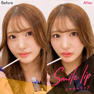 東京銀座A CLINIC デンタルの症例