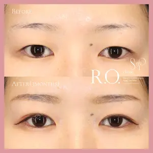 R.O.clinic 辰田　紗世医師の症例