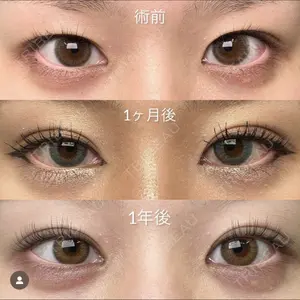 EMMO FACE CLINIC 大阪梅田院 山﨑 冴羅医師の症例