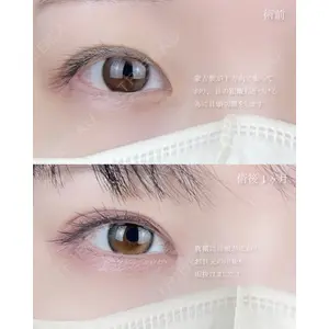 AI Beauty Clinic （エーアイ美容クリニック） 尾崎 宥文医師の症例