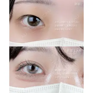 AI Beauty Clinic （エーアイ美容クリニック） 尾崎 宥文医師の症例