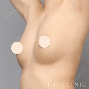 THE CLINIC（ザ・クリニック） 東京院 大橋 昌敬医師の症例