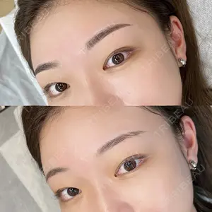 ars clinic TOKYO / GINZAMaisonの症例