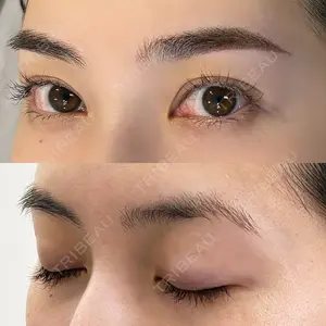 ars clinic TOKYO / GINZAMaisonの症例