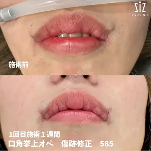ziz CLINICの症例