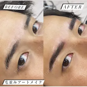 Tokyo Tensei Clinic 新宿院 斉藤美優医師の症例